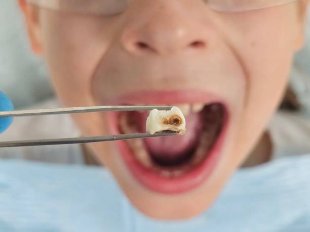 Best Weekend Emergency Dentist in Steiner Ranch, TX